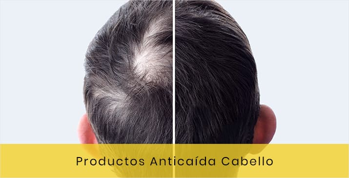 Productos Anticaída Del Cabello - Soluciones eficaces